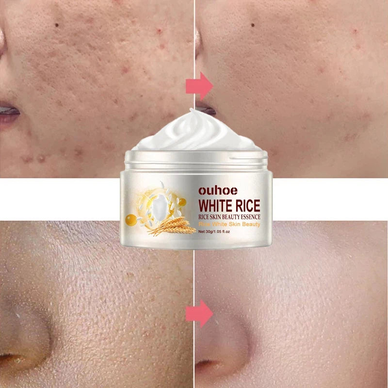 Rice Anti-wrinkle Facial Cream Acne Melasma Treatment Pigmentation Whitening