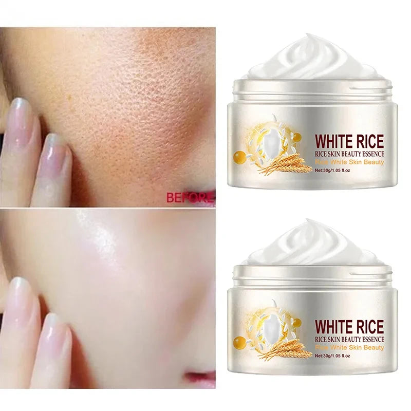 Rice Anti-wrinkle Facial Cream Acne Melasma Treatment Pigmentation Whitening